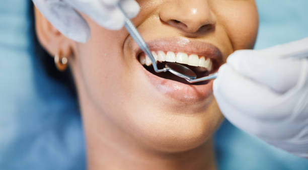 Best Broken or Chipped Tooth Repair in South Greensburg, PA